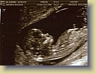 Week12-Ultrasound-01Aug2011 * 3085 x 2314 * (5.44MB)