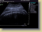 Week32-Siemens-Ultrasound-Dec2011 * 1024 x 768 * (187KB)